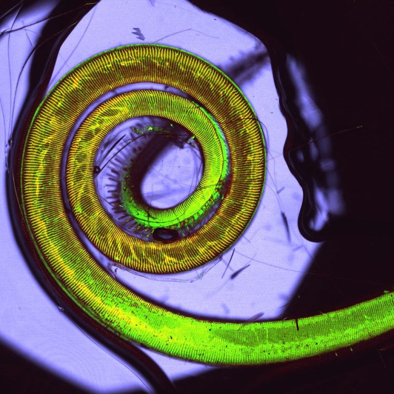 Lepke pödörnyelvének mikroszkópos képe.