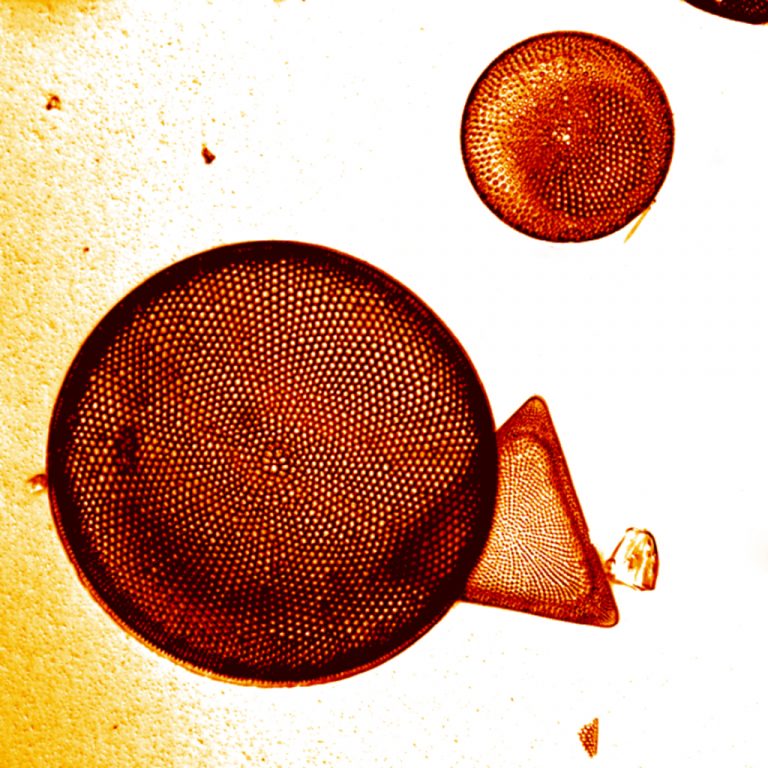 Kovamoszatok mikroszkópos képe.
